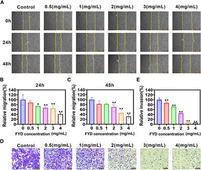 Fuyuan decoction prevents nasopharyngeal carcinoma metastasis by inhibiting circulating tumor cells/ endothelial cells interplay and enhancing anti-cancer immune response